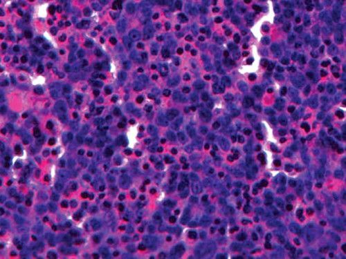 3D生物打印公司Organovo推出人體肝細胞組織打印