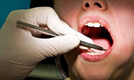 科學家發現能使牙齒再生的藥物(組圖)