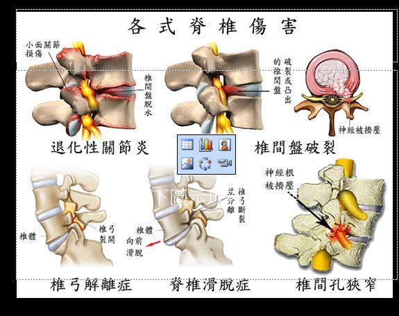 背痛不是背病